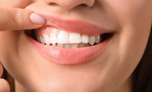 What does the colour of your gums tell you about your health?