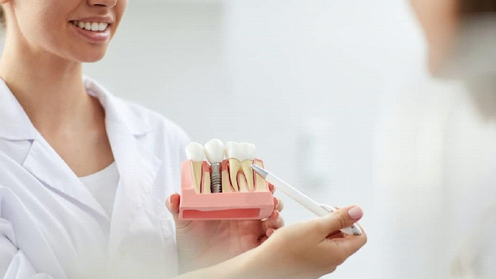 Dental Implants in Turkey: The Process and Materials Used