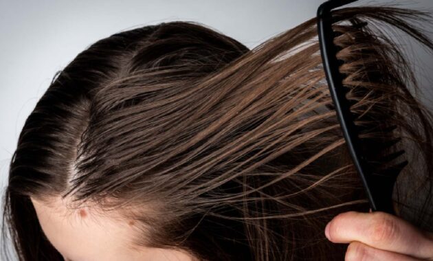 5 best shampoos for oily hair and scalp