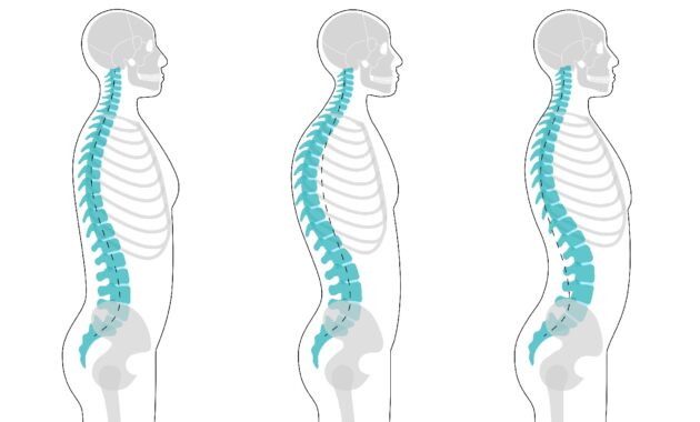 The Hidden Threats: How Poor Posture Poses a Risk to Your Health