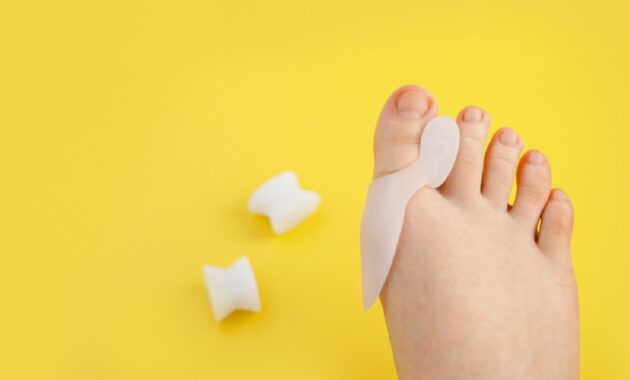 Best bunion correctors: 6 picks to realign toe joints