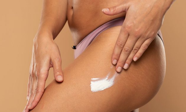 5 effective home remedies for stretch marks on buttocks