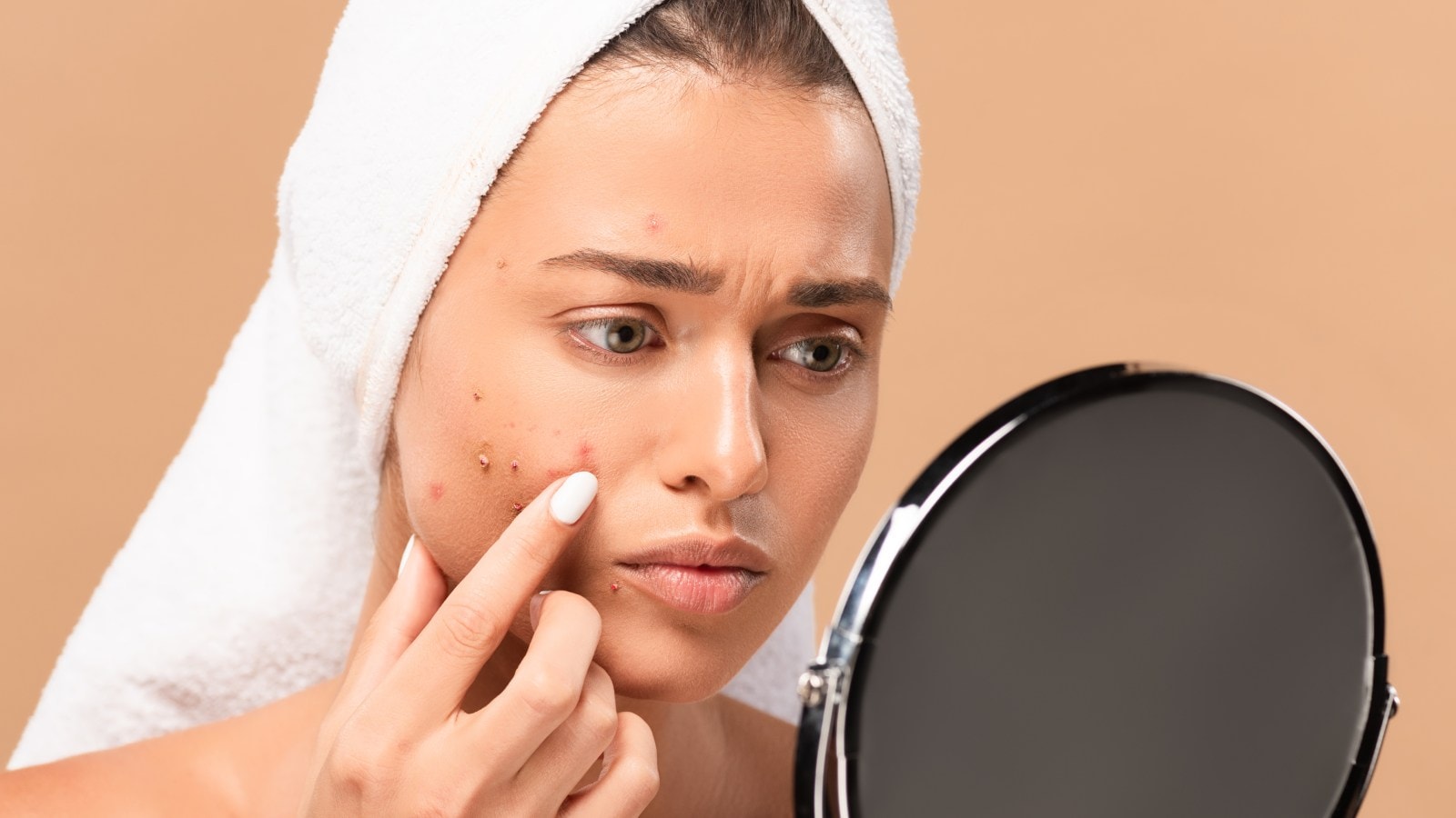 Cystic acne: How to get rid of them naturally?