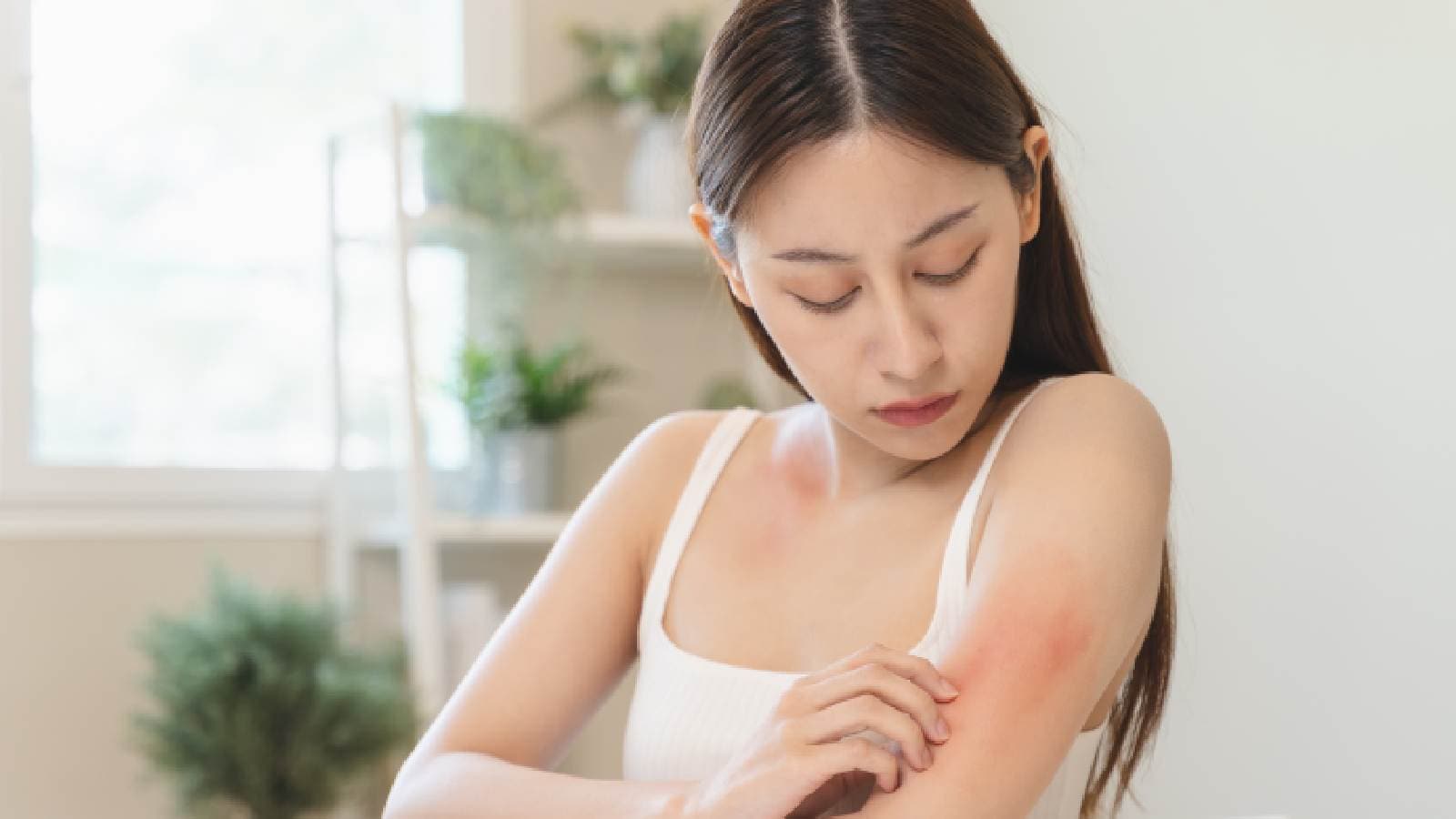 Caterpillar rash: Symptoms and treatment