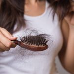 Patchy hair loss: Symptoms, causes and treatment of alopecia areata