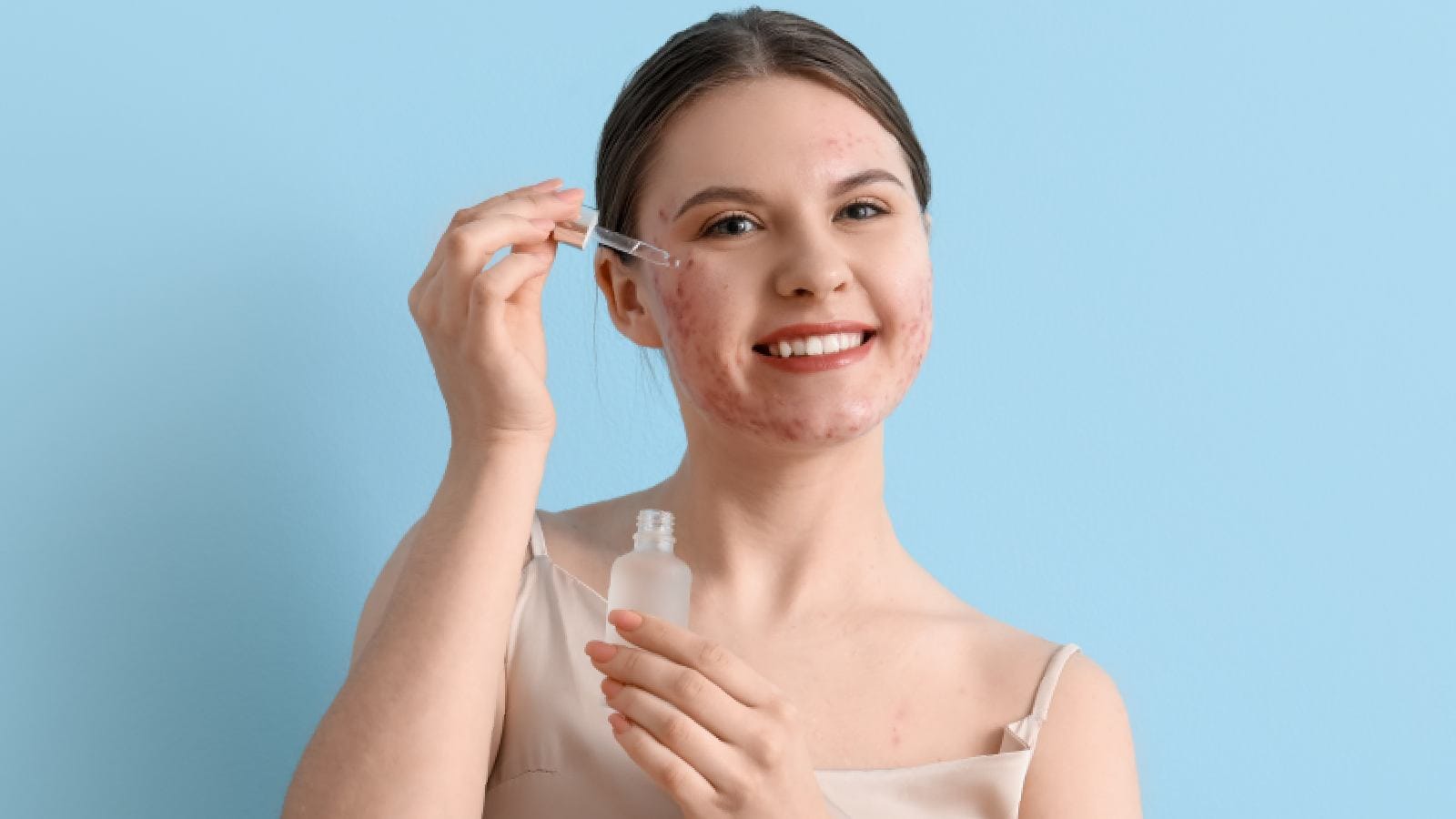 Hyaluronic acid for acne: Know how it helps